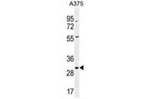 COPE Antibody (C-term) western blot analysis in A375 cell line lysates (35µg/lane).