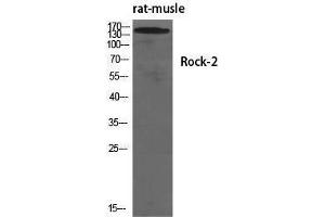Western Blotting (WB) image for anti-rho-Associated, Coiled-Coil Containing Protein Kinase 2 (ROCK2) (Tyr466) antibody (ABIN3186830) (ROCK2 Antikörper  (Tyr466))