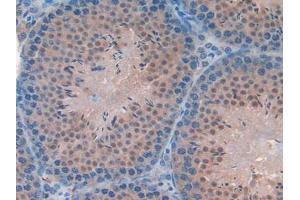IHC-P analysis of Mouse Testis Tissue, with DAB staining. (FAM19A2 Antikörper  (AA 31-119))