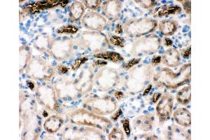 Anti-SLC12A1 antibody, IHC(F) IHC(F): Rat Kidney Tissue (SLC12A1 Antikörper  (N-Term))