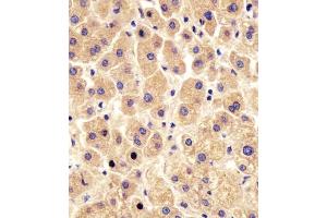 (ABIN6243863 and ABIN6578454) staining PYGL in human liver tissue sections by Immunohistochemistry (IHC-P - paraformaldehyde-fixed, paraffin-embedded sections). (PYGL Antikörper  (AA 809-843))
