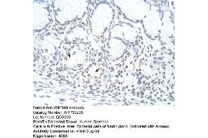 Human Stomach (ZNF580 Antikörper  (N-Term))