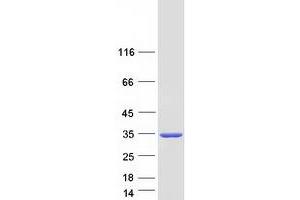 Western Blotting (WB) image for Sulfotransferase Family, Cytosolic, 1A, Phenol-Preferring, Member 1 (SULT1A1) (Transcript Variant 3) protein (Myc-DYKDDDDK Tag) (ABIN2732947)