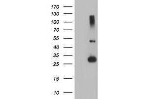 Western Blotting (WB) image for anti-Regulatory Factor X-Associated Ankyrin Containing Protein (RFXANK) antibody (ABIN1500680)