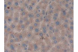 Immunohistochemistry (IHC) image for anti-serpin Peptidase Inhibitor, Clade B (Ovalbumin), Member 1 (SERPINB1) (AA 17-332) antibody (ABIN7443074)