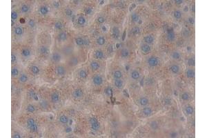 Detection of LEI in Rat Liver Tissue using Polyclonal Antibody to Leukocyte Elastase Inhibitor (LEI) (SERPINB1 Antikörper  (AA 17-332))