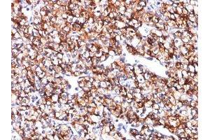 Image no. 1 for anti-Carbonic Anhydrase IX (CA9) antibody (ABIN6182201) (CA9 Antikörper)