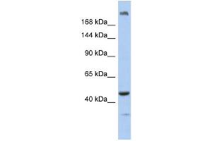 WB Suggested Anti-KIAA0284 Antibody Titration: 0. (KIAA0284 Antikörper  (N-Term))