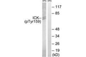 Western blot analysis of extracts from NIH-3T3 cells treated with starved 24h, using ICK (Phospho-Tyr159) Antibody. (ICK Antikörper  (pTyr159))