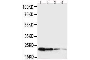 Anti-mouse Growth Hormone antibody, Western blotting Lane 1: Recombinant Mouse GH Protein 10ng Lane 2: Recombinant Mouse GH Protein 5ng Lane 3: Recombinant Mouse GH Protein 2 (Growth Hormone 1 Antikörper  (AA 27-216))