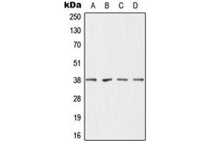 Western blot analysis of DHRS7 expression in MCF7 (A), HepG2 (B), mouse liver (C), rat liver (D) whole cell lysates. (DHRS7 Antikörper  (C-Term))
