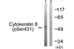 Western blot analysis of extracts from 293 cells treated with EGF 200ng/ml 30', using Keratin 8 (Phospho-Ser432) Antibody. (KRT8 Antikörper  (pSer432))