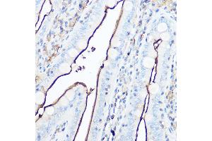 Immunohistochemistry of paraffin-embedded mouse intestin using CD13/ANPEP Rabbit pAb (ABIN6131185, ABIN6136911, ABIN6136912 and ABIN6221309) at dilution of 1:50 (40x lens). (CD13 Antikörper  (AA 668-967))