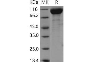 Western Blotting (WB) image for VEGF Receptor 2 (VEGFR2) protein (His tag) (ABIN7320077)