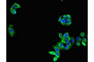 Immunofluorescent analysis of PC-3 cells using ABIN7158996 at dilution of 1:100 and Alexa Fluor 488-congugated AffiniPure Goat Anti-Rabbit IgG(H+L) (MARK3 Antikörper  (AA 368-667))