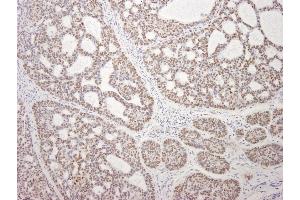 Immunohistochemistry (IHC) image for anti-Mdc1 (MDC1) (AA 1375-1425) antibody (ABIN7448658)
