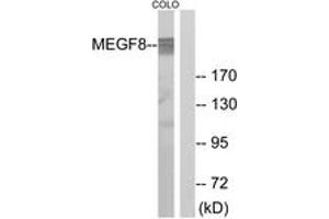 Western blot analysis of extracts from COLO cells, using MEGF8 Antibody.
