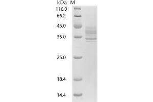(Tris-Glycine gel) Discontinuous SDS-PAGE (reduced) with 5 % enrichment gel and 15 % separation gel.