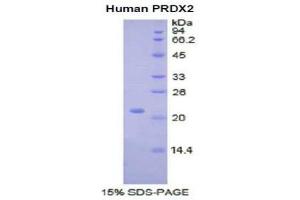 SDS-PAGE (SDS) image for Peroxiredoxin 2 (PRDX2) (AA 6-164) protein (His tag) (ABIN1877329)