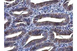 Immunohistochemistry (IHC) image for anti-Spleen tyrosine Kinase (SYK) (Internal Region) antibody (ABIN2854855)