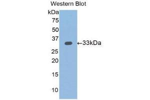Western Blotting (WB) image for anti-Slit Homolog 1 (SLIT1) (AA 345-623) antibody (ABIN1176116) (SLIT1 Antikörper  (AA 345-623))