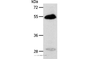 Western blot analysis of Human liver cancer tissue, using CA14 Polyclonal Antibody at dilution of 1:400 (CA14 Antikörper)