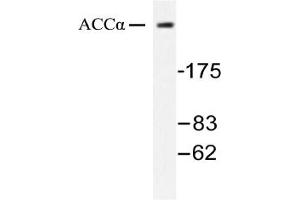 Image no. 1 for anti-Acetyl-CoA Carboxylase alpha (ACACA) antibody (ABIN271866) (Acetyl-CoA Carboxylase alpha Antikörper)