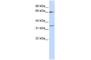 WB Suggested Anti-ZNF157 Antibody Titration:  0. (ZNF157 Antikörper  (N-Term))