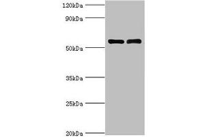 Western blot All lanes: IL7R antibody at 4 μg/mL Lane 1: K562 whole cell lysate Lane 2: Jurkat whole cell lysate Secondary Goat polyclonal to rabbit IgG at 1/10000 dilution Predicted band size: 52, 35, 30, 29 kDa Observed band size: 52 kDa