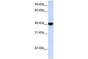 G6PC antibody used at 1 ug/ml to detect target protein. (G6PC Antikörper  (N-Term))
