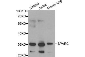 Western blot analysis of extracts of various cell lines, using SPARC antibody. (SPARC Antikörper  (AA 18-303))