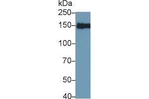 Detection of IRS2 in MCF7 cell lysate using Polyclonal Antibody to Insulin Receptor Substrate 2 (IRS2) (IRS2 Antikörper)