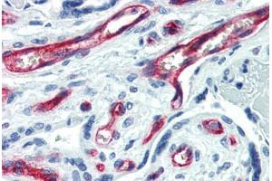 Human Placenta (formalin-fixed, paraffin-embedded) stained with CD34 antibody ABIN461990 at 1:50 followed by biotinylated anti-mouse IgG secondary antibody ABIN481714, alkaline phosphatase-streptavidin and chromogen. (CD34 Antikörper  (FITC))