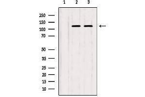 Western blot analysis of extracts from various samples, using IP3KB Antibody. (ITPKB Antikörper  (Internal Region))