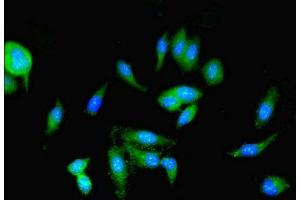 Immunofluorescent analysis of Hela cells using ABIN7166912 at dilution of 1:100 and Alexa Fluor 488-congugated AffiniPure Goat Anti-Rabbit IgG(H+L) (PKM Antikörper  (AA 2-192))