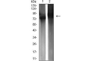 Western blot analysis using IGHM mouse mAb against Raji (1) and Ramos (2) cell lysate. (IGHM Antikörper  (AA 310-452))