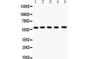 Anti-NR5A2 Picoband antibody, (ABIN3043579), Western blottingAll lanes: Anti NR5A2 (ABIN3043579) at 0.