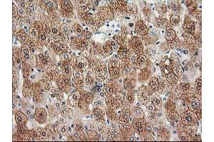 Immunohistochemical staining of paraffin-embedded Human liver tissue using anti-HDHD2 mouse monoclonal antibody. (HDHD2 Antikörper)