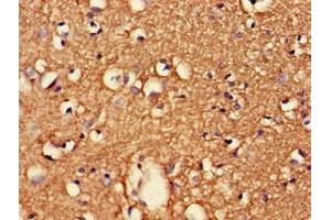 Immunohistochemistry (IHC) image for anti-CDK5 Regulatory Subunit Associated Protein 2 (CDK5RAP2) (AA 996-1111), (Regulatory Subunit) antibody (ABIN7147230)
