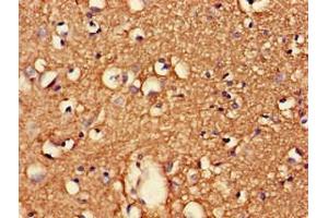 Immunohistochemistry of paraffin-embedded human brain tissue using ABIN7147230 at dilution of 1:100 (CDK5RAP2 Antikörper  (Regulatory Subunit))