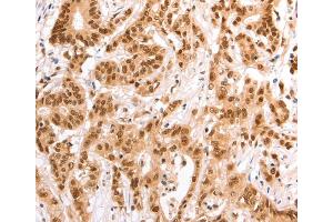 Immunohistochemistry (IHC) image for anti-Tax1 (Human T-Cell Leukemia Virus Type I) Binding Protein 1 (TAX1BP1) antibody (ABIN5543832) (TAX1BP1 Antikörper)