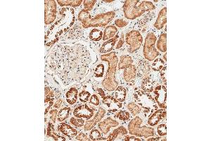 Immunohistochemistry (Paraffin-embedded Sections) (IHC (p)) image for anti-Leukemia Inhibitory Factor (LIF) (AA 72-101) antibody (ABIN390969)