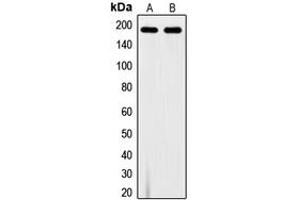 Western blot analysis of VEGFR1 (pY1213) expression in A10 (A), MDAMB231 (B) whole cell lysates. (FLT1 Antikörper  (C-Term, pTyr1213))