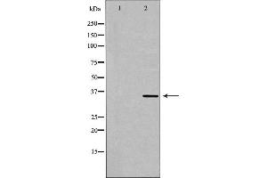 Western blot analysis of Hela whole cell lysates, using MNAT1 Antibody. (MNAT1 Antikörper  (N-Term))