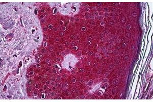 Human Skin: Formalin-Fixed, Paraffin-Embedded (FFPE) (TNF alpha Antikörper  (AA 1-234))