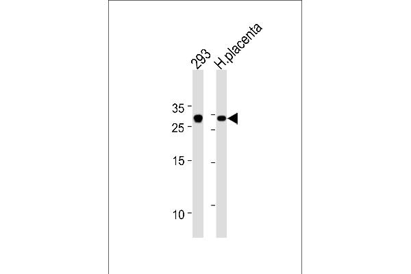 TCF21 Antikörper  (C-Term)