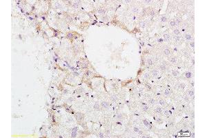 Immunohistochemistry (Paraffin-embedded Sections) (IHC (p)) image for anti-Eukaryotic Translation Initiation Factor 2 alpha Kinase 4 (EIF2AK4) (pThr899) antibody (ABIN684943)