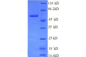 SDS-PAGE (SDS) image for Hemopexin (HPX) (AA 24-460) protein (His tag) (ABIN5709683)