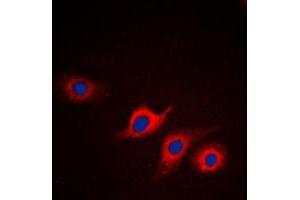 Immunofluorescent analysis of Apolipoprotein L2 staining in HepG2 cells.