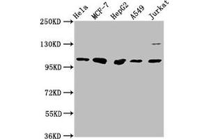 Western Blot Positive WB detected in: Hela whole cell lysate, MCF-7 whole cell lysate, HepG2 whole cell lysate, A549 whole cell lysate, Jurkat whole cell lysate All lanes: GANC antibody at 1:1000 Secondary Goat polyclonal to rabbit IgG at 1/50000 dilution Predicted band size: 105 kDa Observed band size: 105 kDa (GANC Antikörper  (AA 171-318))
